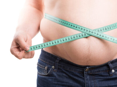 abdominoplastie